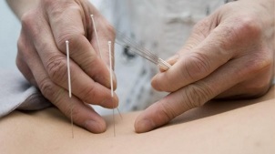 Akupunktur bei lumbaler Osteochondrose