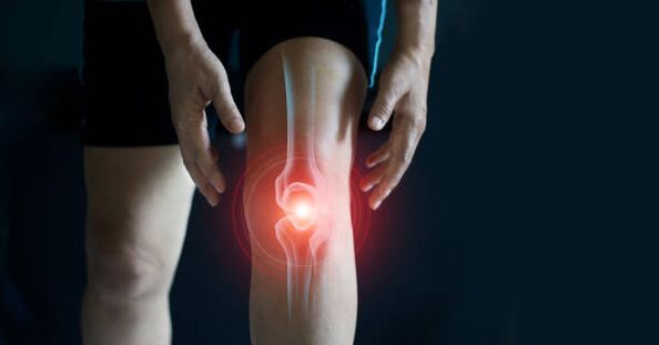 Arthrose des Kniegelenks